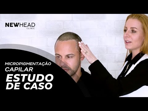 Estudo de Caso — Newhead Clinic