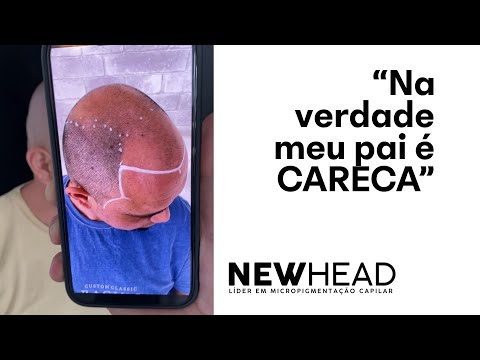 Depoimento — Meu pai careca