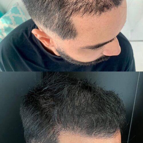 Publicação da Newhead Clinic no Instagram